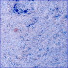 SIF_1396_0790869396_496EBY_N0650000SRLC00454_0000LMJ