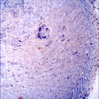 SIF_1396_0790869427_699EBY_N0650000SRLC00454_0000LMJ