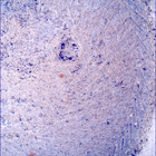 SIF_1396_0790869434_933EBY_N0650000SRLC00454_0000LMJ