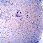 SIF_1396_0790869436_742EBY_N0650000SRLC00454_0000LMJ